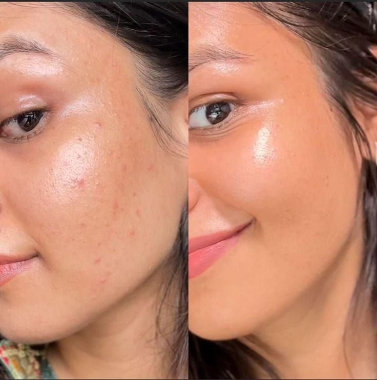 Skin Polish Kit